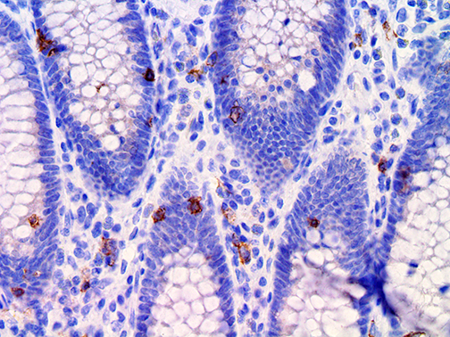 1. IHC of CD103 on a FFPE Colon Tissue Spec Sheet and catalog Webpage