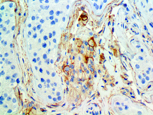 1. IHC of CD105 on a FFPE Testis Tissue Spec Sheet Catalog and Webpage