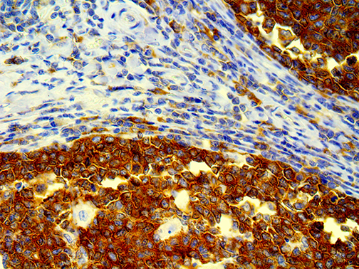 3. 1. Ihc Of Hgal Of Ffpe Tonsil Tissue Webpage