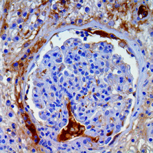 3. Amyloid A on a FFPE Kidney Tissue Webpage