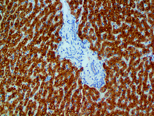 3. Ihc Of Cox2 On A Ffpe Liver Tissue Webpage