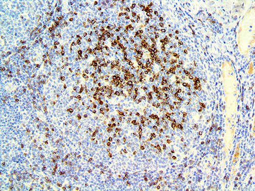3. Ihc Of Igd On A Ffpe Tonsil Webpage