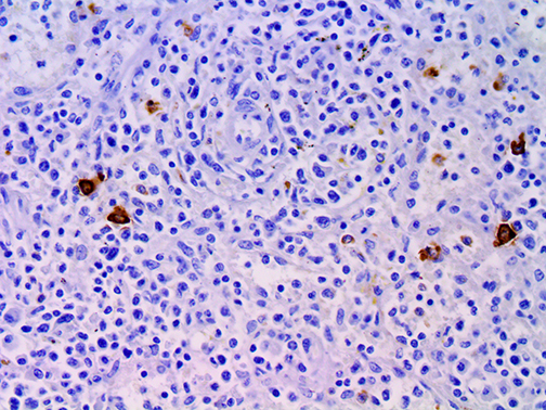 3. IHC of Neutrophil Elastase on a FFPE SpleenTissue Webpage
