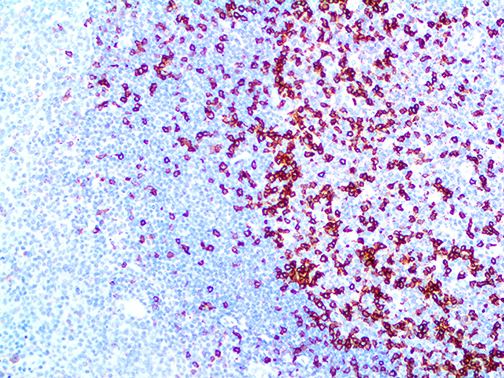 3. IHC of PD1 on a FFPE Tonsil Tissue Webpage
