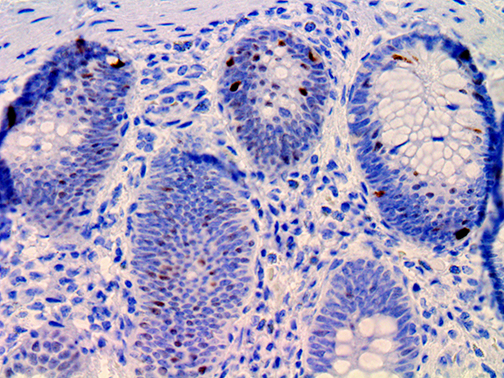 3. IHC of PDX 1 on a FFPE Colon Tissue Webpage Avoid folds