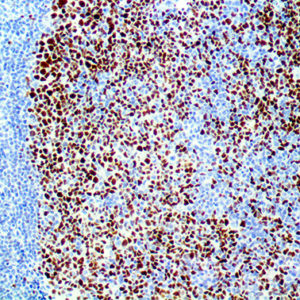 3. IHC of bcl6 on a FFPE Tonsil Tissue Webpage