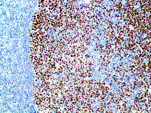3. IHC of bcl6 on a FFPE Tonsil Tissue Webpage