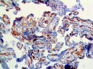 CD34 ALK Brown Placenta