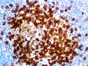 IHC of CD43 on an FFPE Tonsil Tissue
