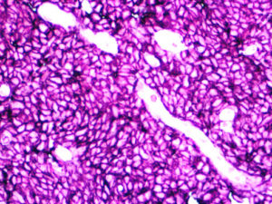 IHC of CD45 on an FFPE Tonsil Tissue