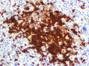 IHC of CD45RA on an FFPE Tonsil Tissue
