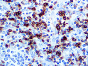 IHC of CD7 on an FFPE Tonsil Tissue