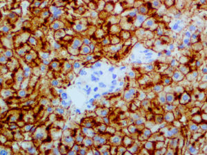 IHC of CD75 on an FFPE Liver Tissue
