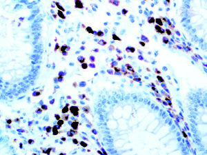 IHC of CD79a on an FFPE Colon Tissue