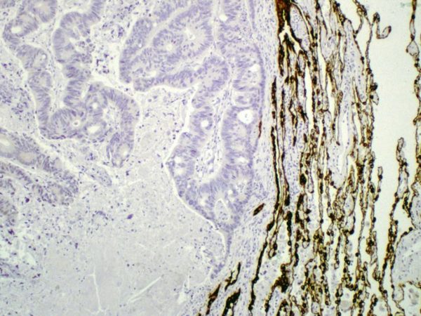 Cytokeratin 7 Rmab 1