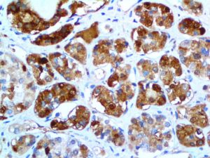 IHC of FSH on an FFPE Pituitary Tissue