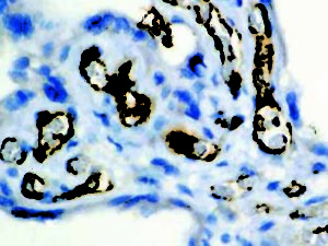 IHC of Factor VIII on an FFPE Placenta Tissue