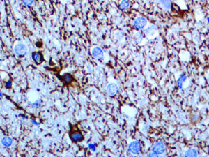 IHC of GFAP on an FFPE on a Brain Tissue