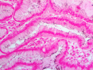 IHC of Helicobacter pylori on an FFPE Infected Stomach Tissue