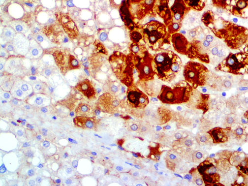 Hepatitus B Surface Antigen Mmab