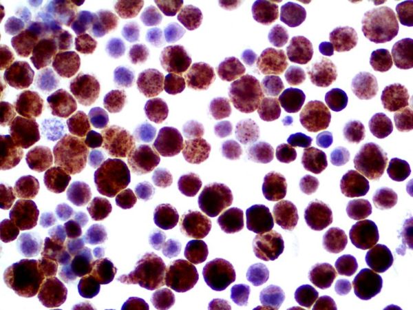 Ihc Of Hsv Iii On Ffpe Infected Cell Line