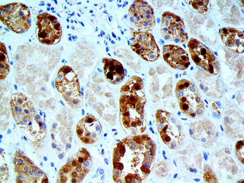 IHC of Parvalbumin on an FFPE Kidney Tissue