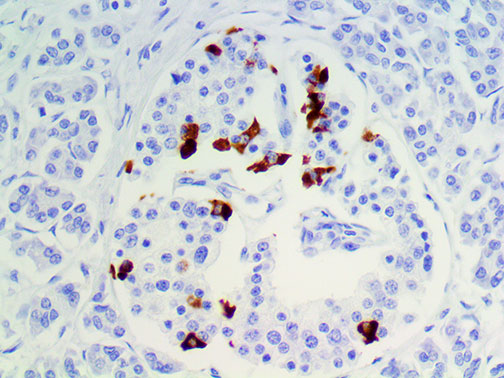 IHC of Somatostatin on an FFPE Pancreas Tissue