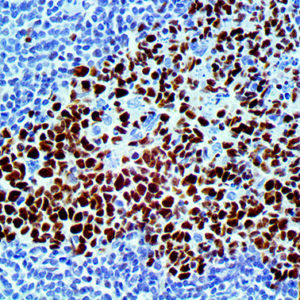 IHC of bcl6 on an FFPE Colon Tissue