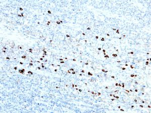 IHC of IgG4 on an FFPE Tonsil Tissue