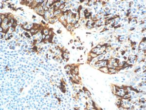 IHC of Lysozyme on an FFPE Tonsil Tissue