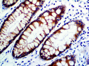 IHC of MUC1 on an FFPE Colon Tissue