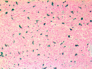 IHC of Macrophage on an FFPE Liver Tissue