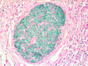 IHC of NSE on an FFPE Pancreas Tissue