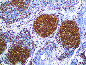 IHC of PAX-5 on an FFPE Tonsil Tissue
